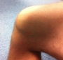 Medial Knee